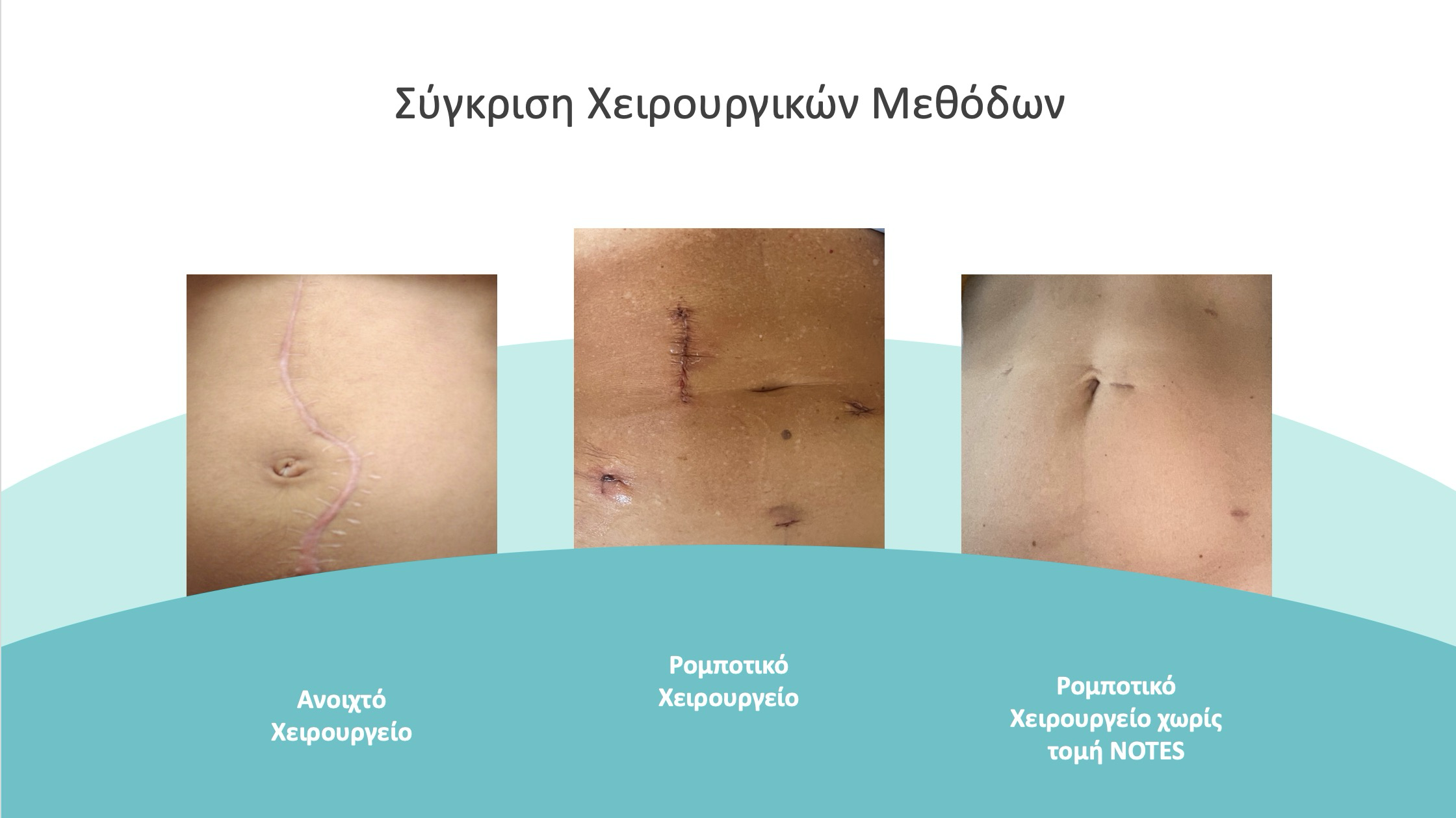 NOTES petropoulou surgery